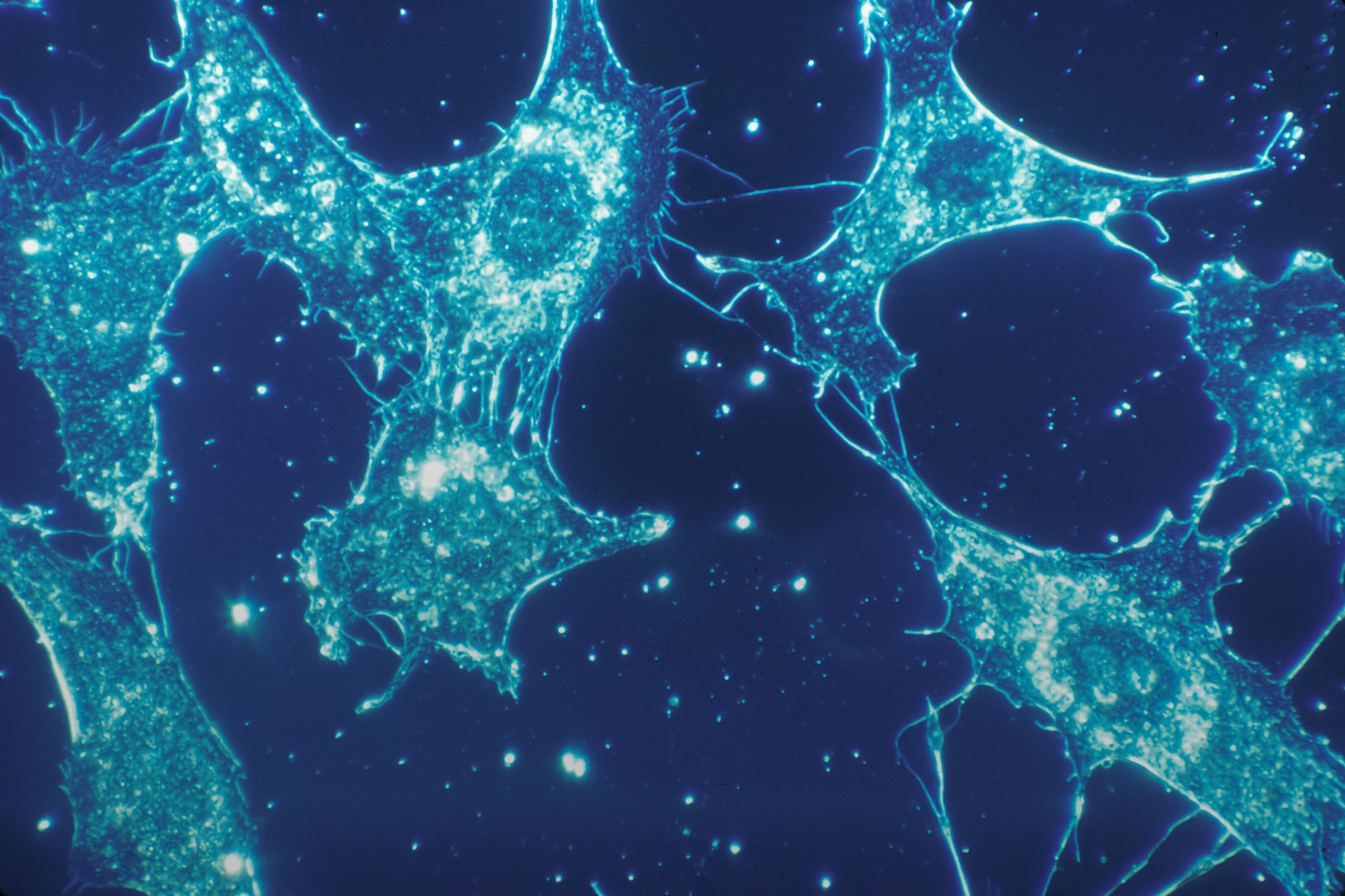 Células vistas al microscopio de fluorescencia